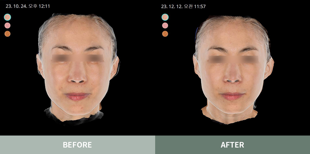 전후사진02