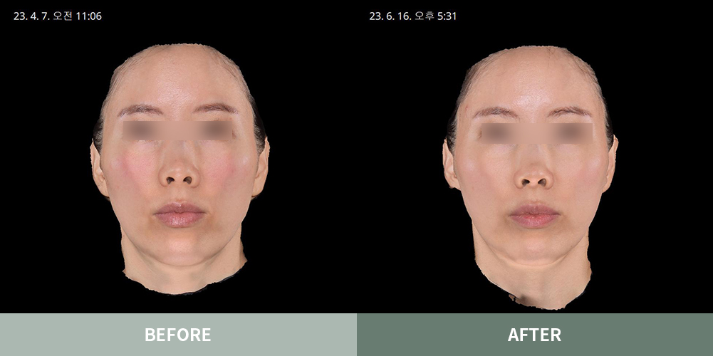 전후사진07