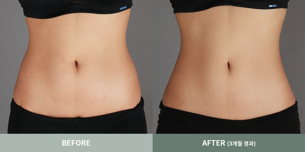 전후사진03