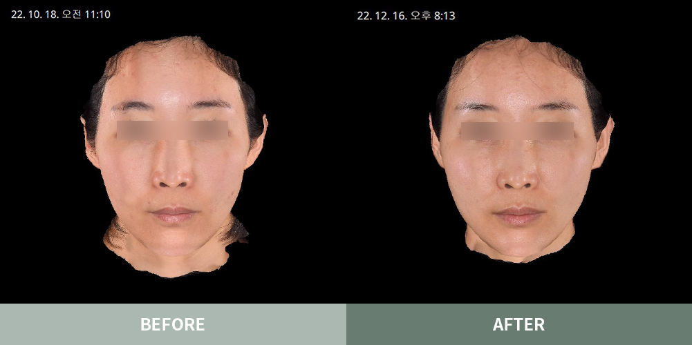 전후사진06