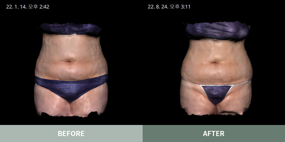 전후사진03