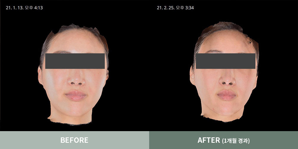 전후사진03