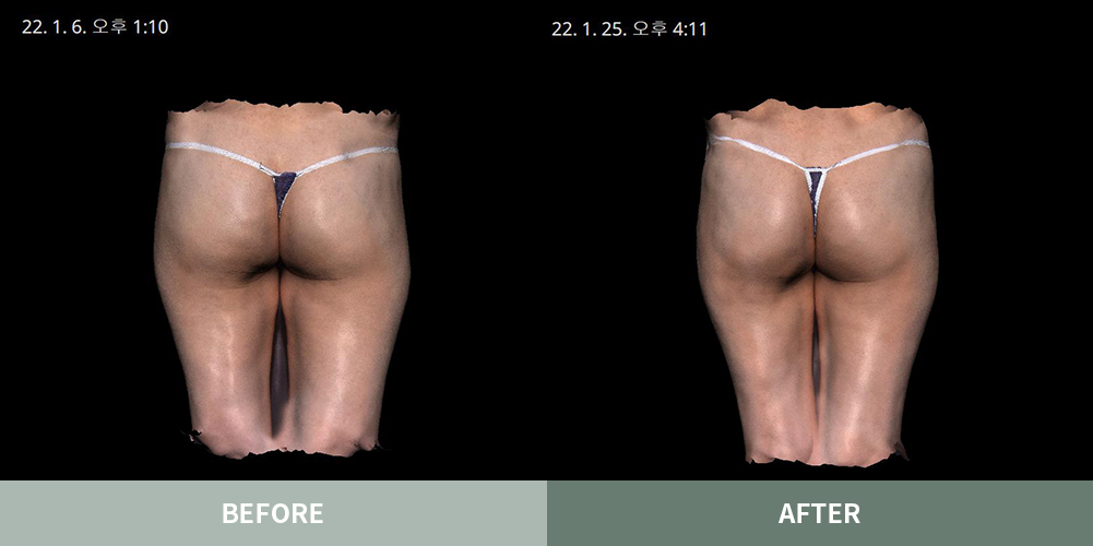 전후사진01